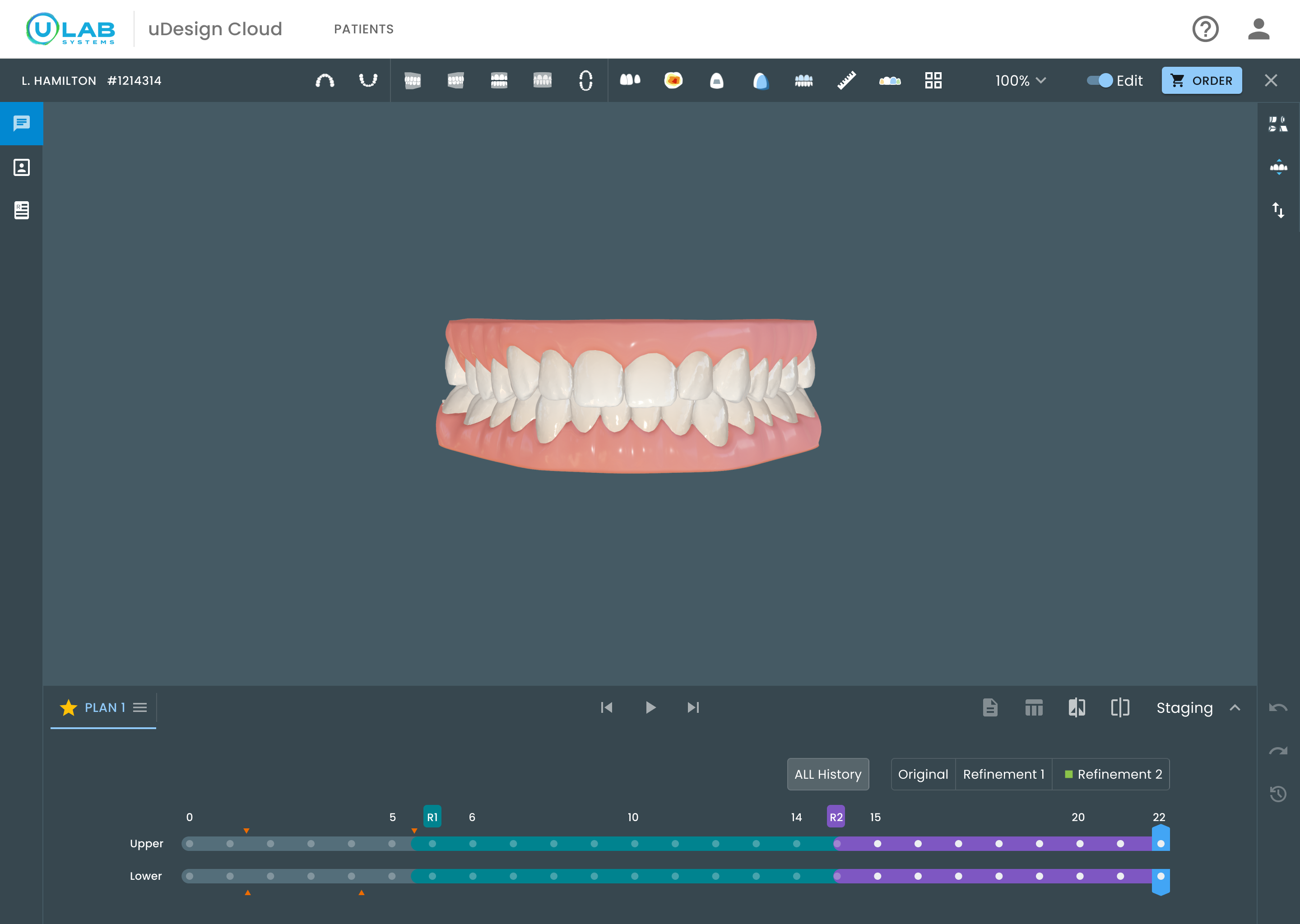 Redesigned uDesign timeline using dots for stages and colored bands to separate the original plan from refinements