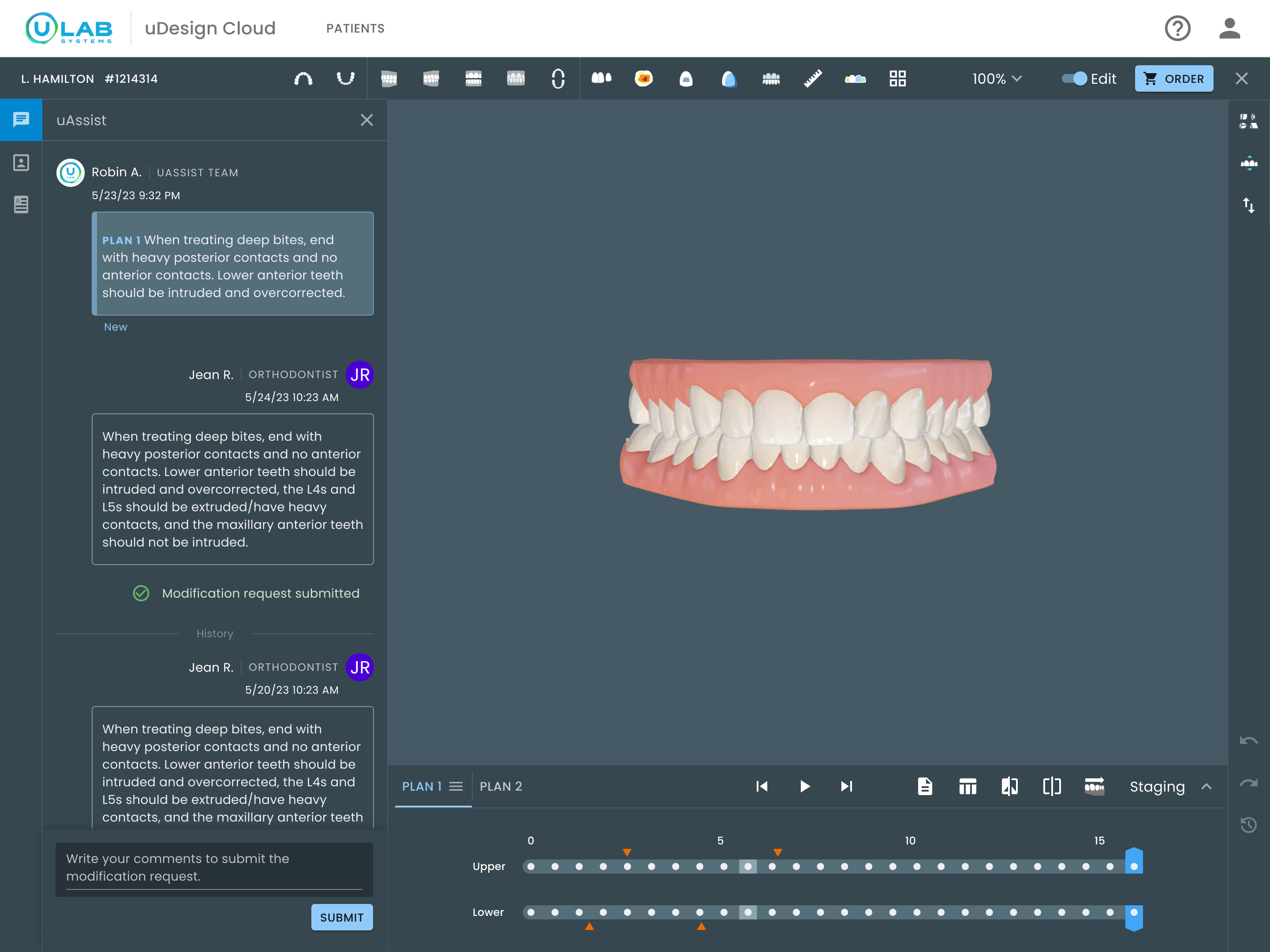 uDesign Cloud treatment-plan review workspace showing uAssist messages, the central 3D model, treatment controls, and the staging timeline